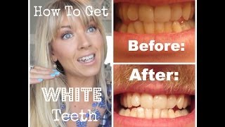 ❤ How To Get WHITE Teeth at Home Demo amp Actual Pictures ❤ [upl. by Ienttirb]