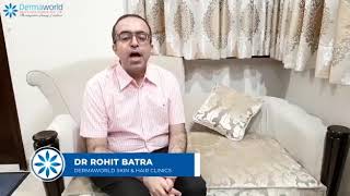 How to remove Birthmarks  Beckers Nevus Treatment  Dr Rohit Batra [upl. by Atsyrk]