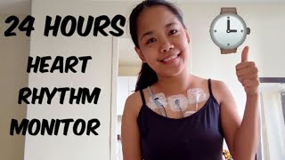 24 hours Holter Monitor Test experience [upl. by Michaele328]