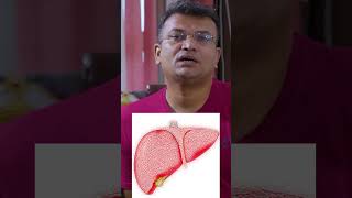 What is Liver cancer  लिवर कैंसर क्या होता है  cancertreatment cancer livercancer cancerstage [upl. by Ecirb293]