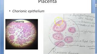 Obstetrics 243 GESTATIONAL TROPHOBLASTIC DISEASES Placental tumor Hydatidiform Mole Choriocarcinoma [upl. by Agni]