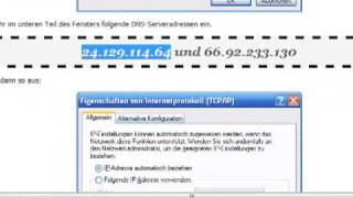 Tutorial DNS Einstellung ändern bei Vista [upl. by Thirza]