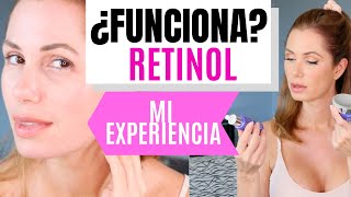 ¿FUNCIONA EL RETINOL Mi experiencia  Desiree Lowry [upl. by Daveda295]