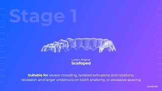 SureSmile Adaptive Trimlinetechnologie [upl. by Ellerd]