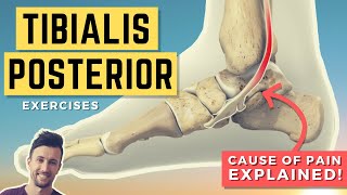 Tibialis Posterior Exercises Treat the Root Cause of Your Tib Post Pain PTTD [upl. by Blight]