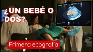 PRIMERA ECOGRAFÍA 6 SEMANAS EMBARAZO  Latido cardiaco ¿Un bebé o dos ¿GEMELOS [upl. by Kluge]