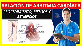 ABLACION CARDIACA POR ARRITMIA [upl. by Inaleon]