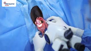 Basics of Colposcopy Procedure [upl. by Noval]