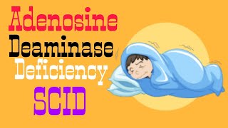 Adenosine Deaminase Deficiency  SCID  Lecture 8 [upl. by Jabez]