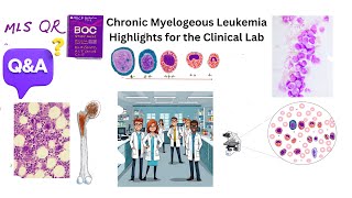 Chronic Myelogenous Leukemia [upl. by Suivat]