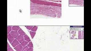 Histopathology Skeletal muscleAtrophy [upl. by Athalia]