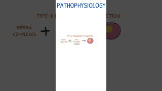 SYSTEMIC LUPUS ERYTHEMATOSUS  Pathophysiology [upl. by Deering455]