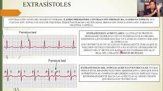 FISIOLOGÍA ARRITMIAS CARDIACAS y SU INTERPRETACIÓN ELECTROCARDIOGRÁFICA [upl. by Shelba849]