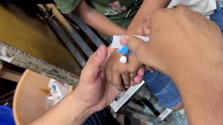 Intravenous iv Cannulation  नस में cannula लगाना सीखे  IV Cannulation  Inject cannula for vein [upl. by Maclaine557]